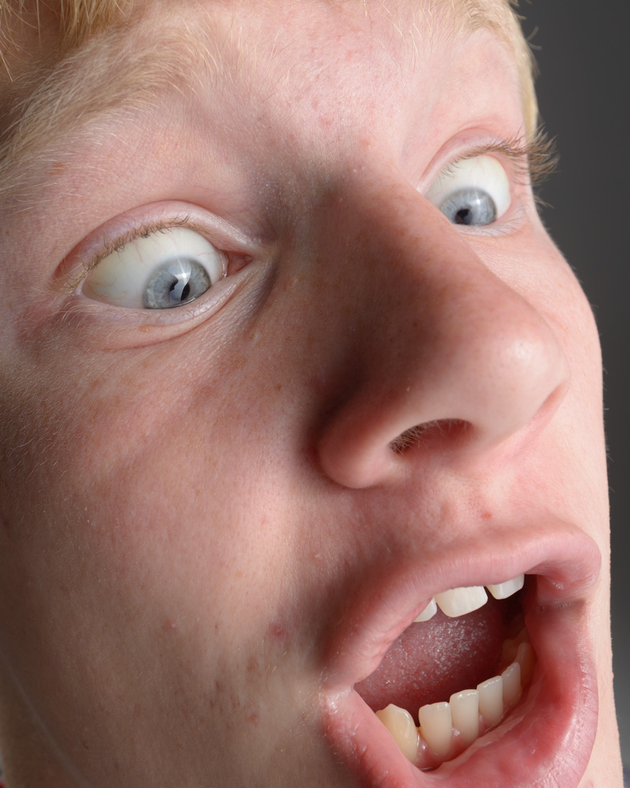 Stacey Ransom Pimple face